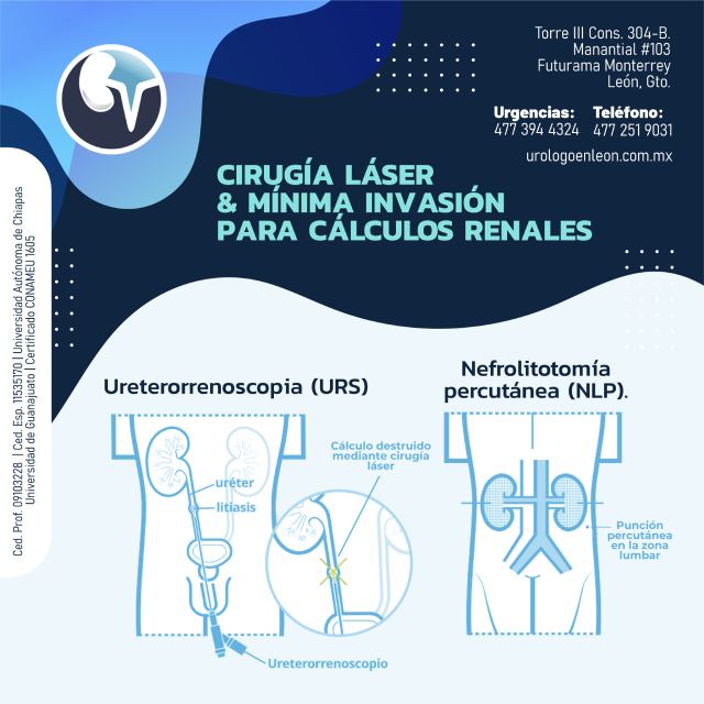 Cirugía Láser y Mínima Invasión para cálculos renales.