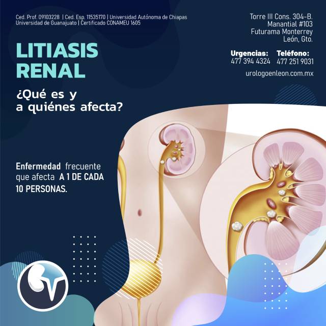 Litiasis renal